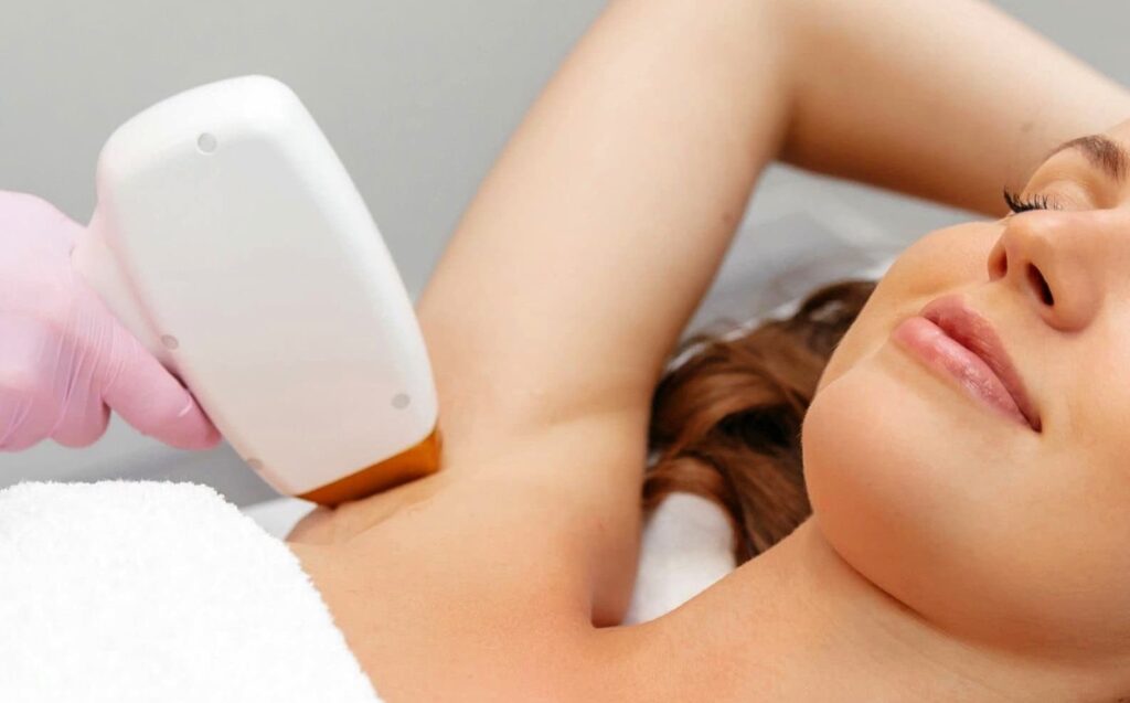 woman getting ipl for her underarm